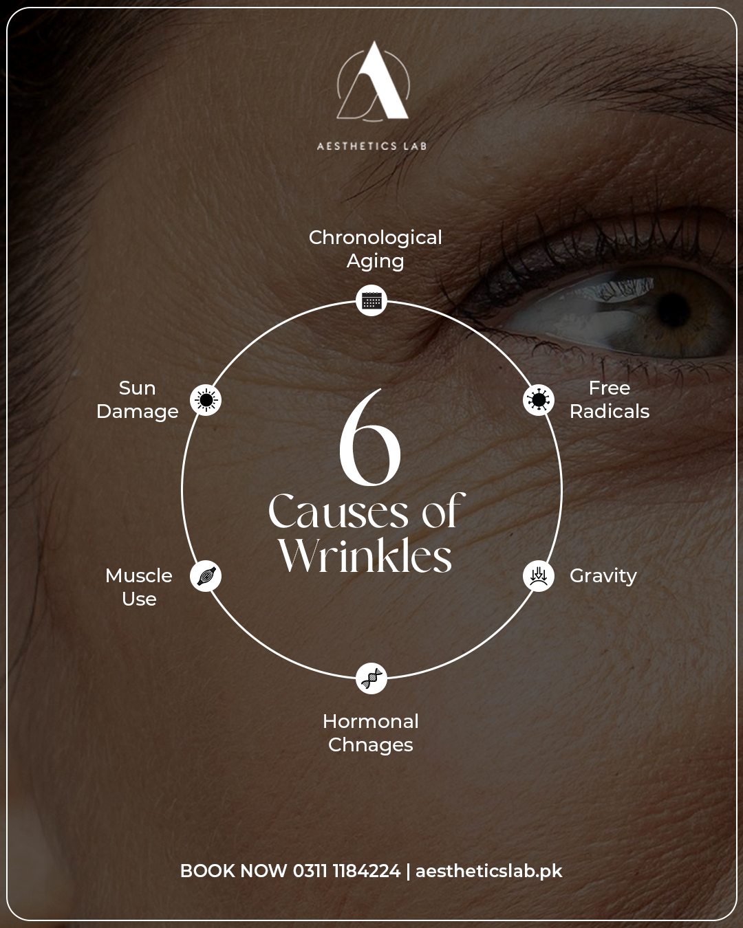 Causes of wrinkles